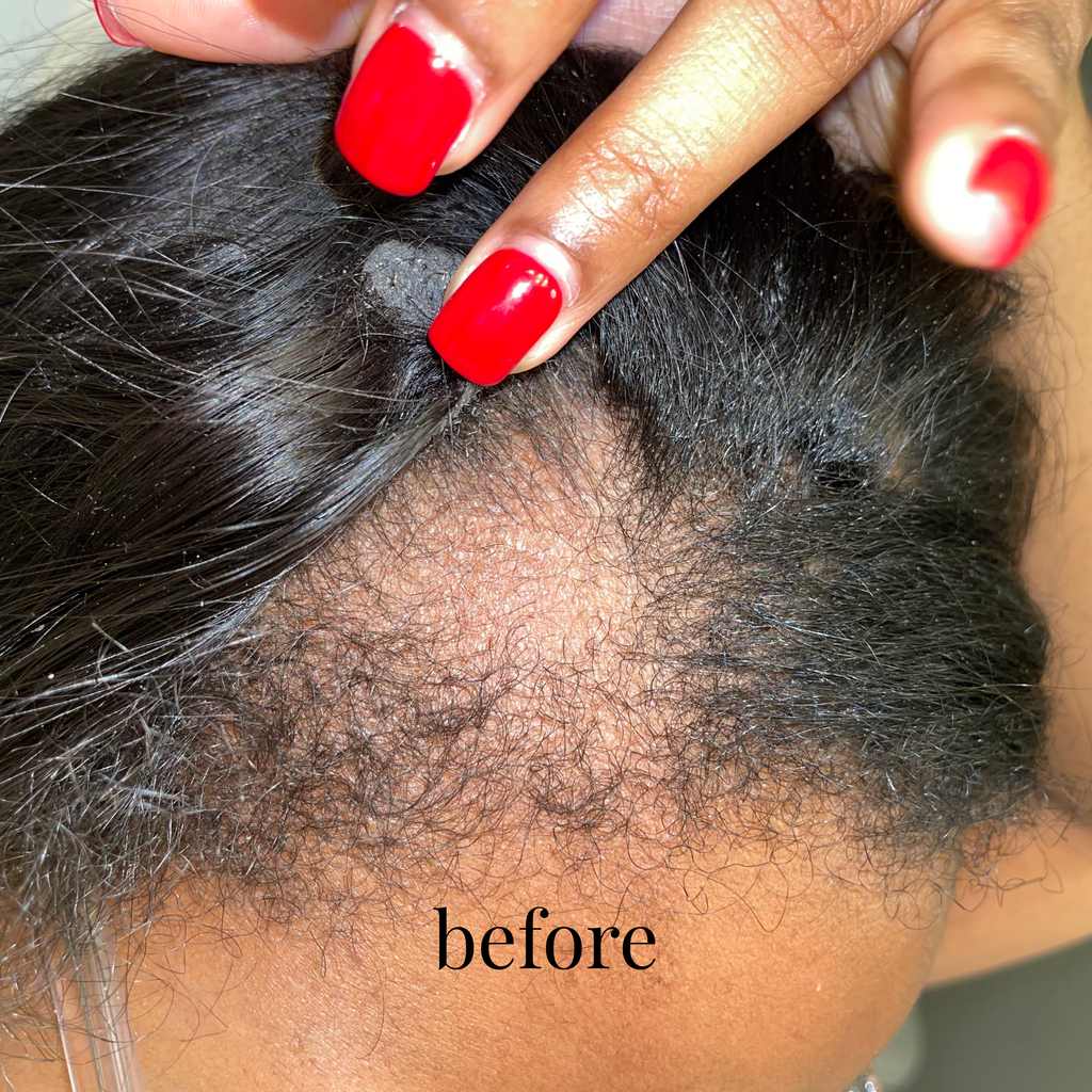 Hair Growth Elixir