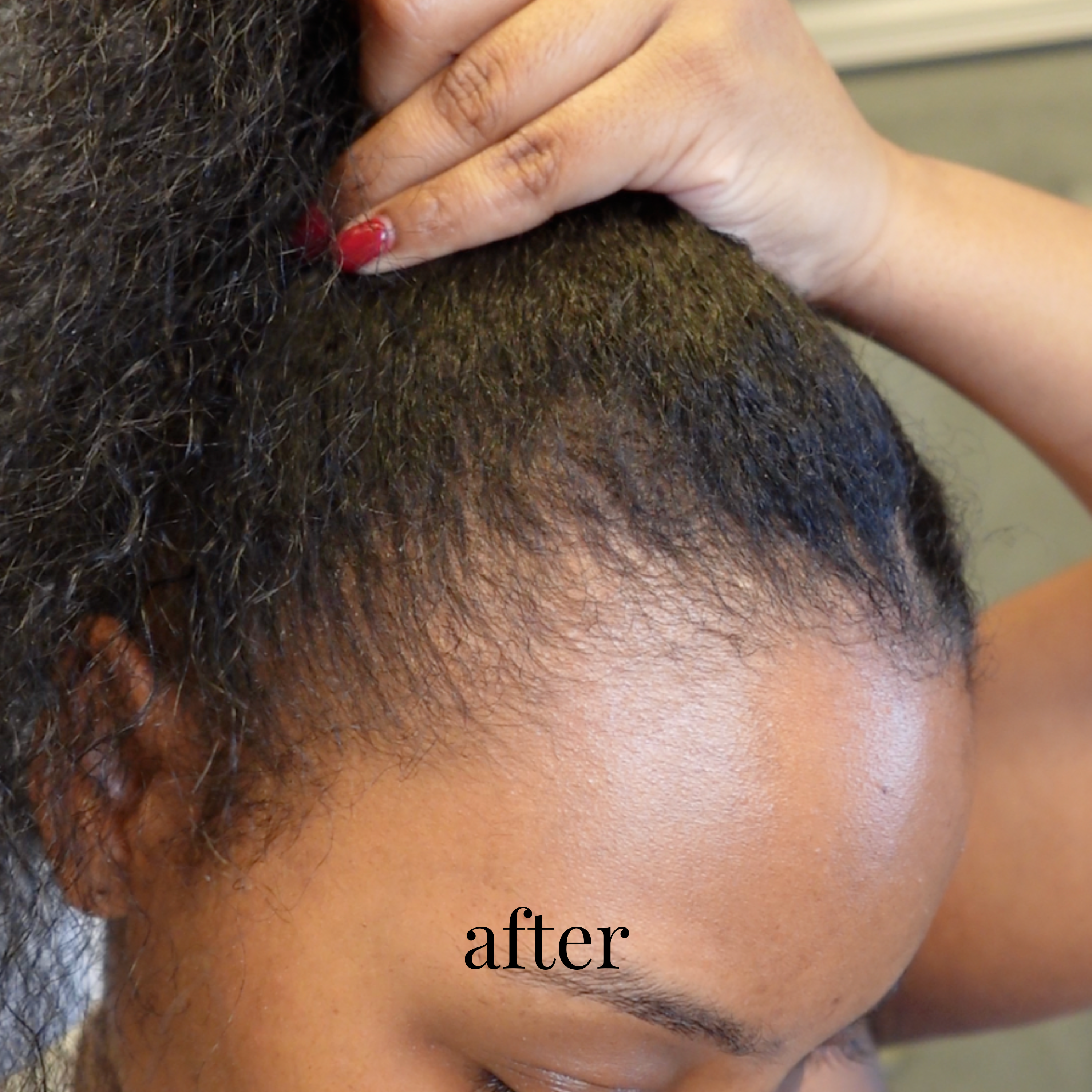 Hair Growth Elixir