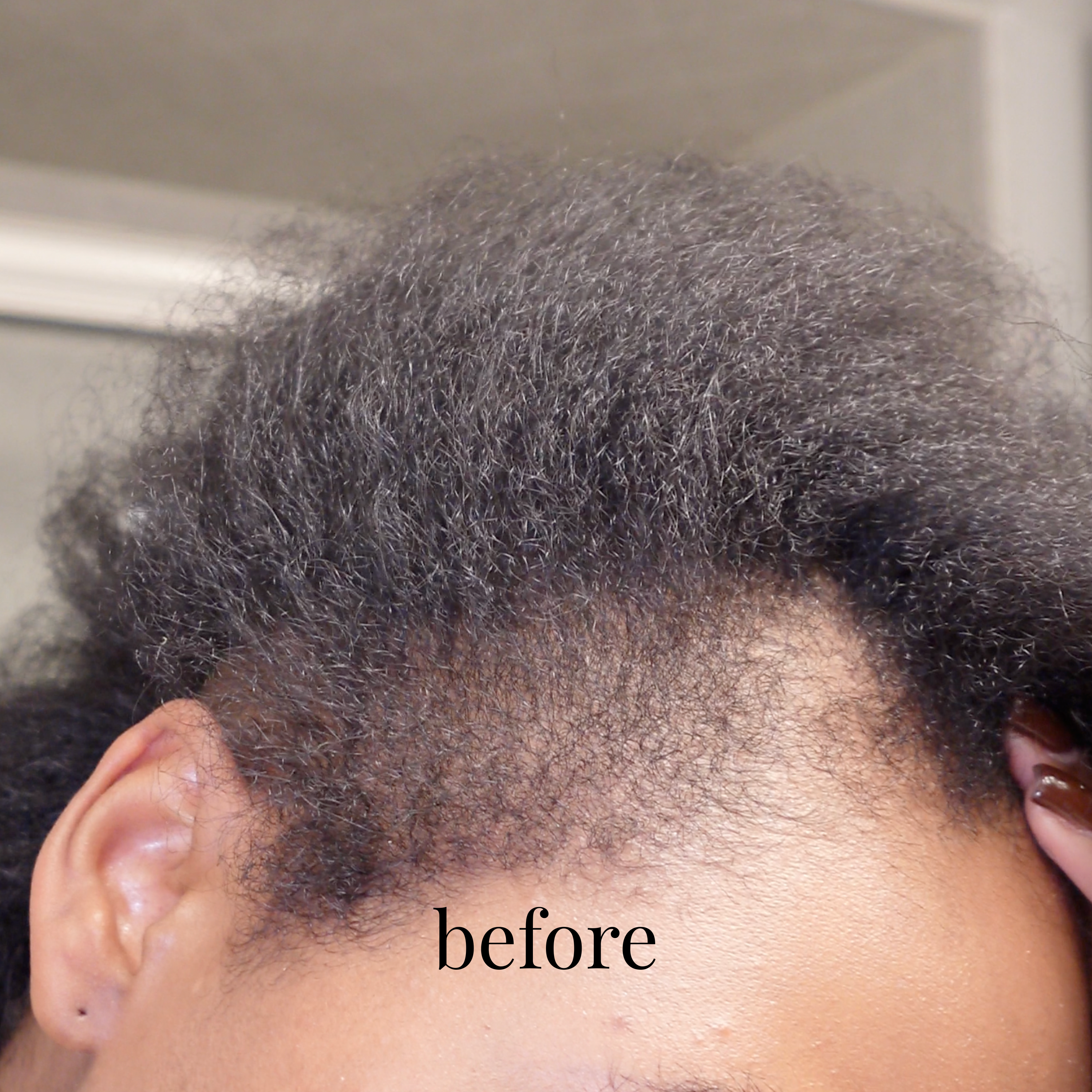 Hair Growth Elixir