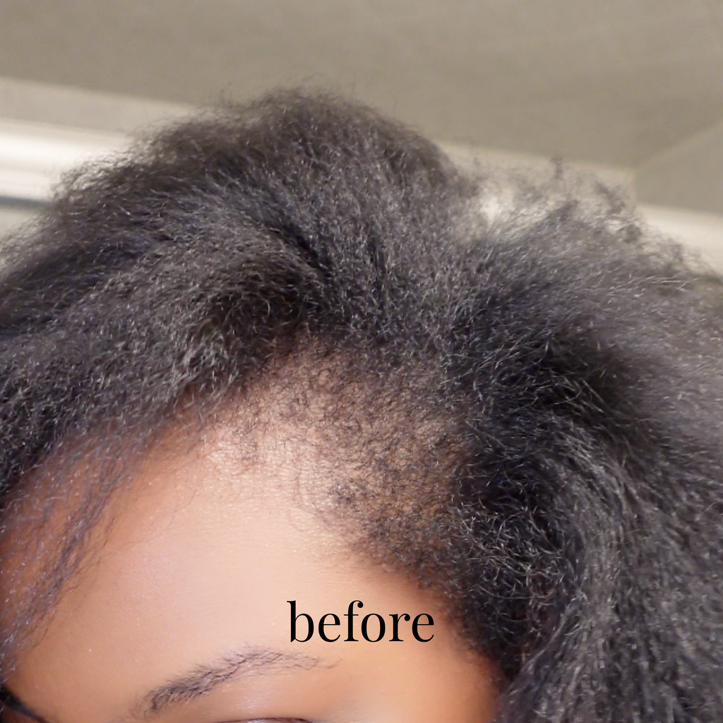 Hair Growth Elixir
